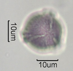 Washington State Honey Pollen Under the Microscope