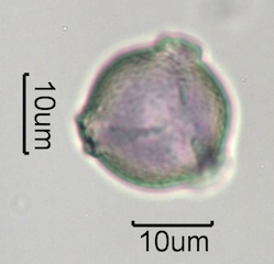 Washington State Honey Pollen Under the Microscope