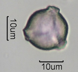 Washington State Honey Pollen Under the Microscope