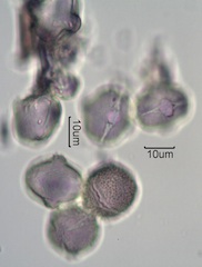 Washington State Honey Pollen Under the Microscope