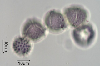 Washington State Honey Pollen Under the Microscope