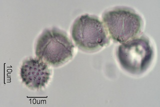 Washington State Honey Pollen Under the Microscope