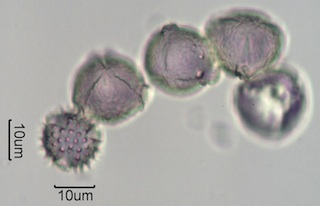 Washington State Honey Pollen Under the Microscope