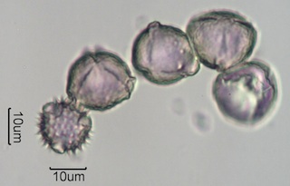 Washington State Honey Pollen Under the Microscope