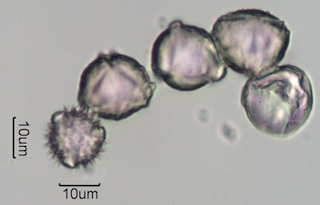 Washington State Honey Pollen Under the Microscope