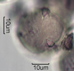 Washington State Honey Pollen Under the Microscope