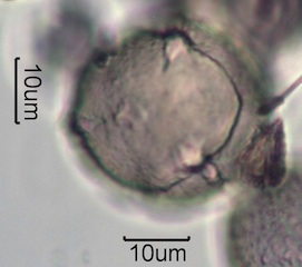 Washington State Honey Pollen Under the Microscope