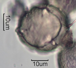 Washington State Honey Pollen Under the Microscope