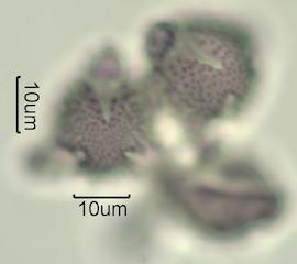 Washington State Honey Pollen Under the Microscope