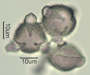 Washington State Honey Pollen Under the Microscope