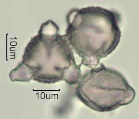 Washington State Honey Pollen Under the Microscope