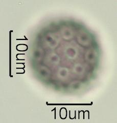 Washington State Honey Pollen Under the Microscope