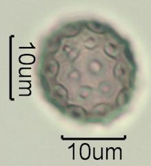 Washington State Honey Pollen Under the Microscope