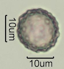 Washington State Honey Pollen Under the Microscope