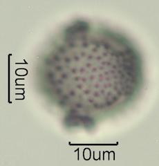 Washington State Honey Pollen Under the Microscope