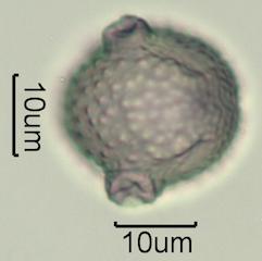 Washington State Honey Pollen Under the Microscope