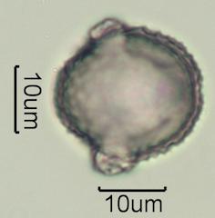 Washington State Honey Pollen Under the Microscope