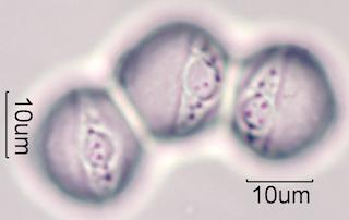 Horse Chestnut Pollen Under the Microscope