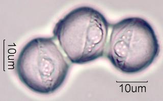 Horse Chestnut Pollen Under the Microscope