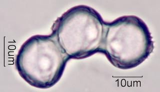 Horse Chestnut Pollen Under the Microscope