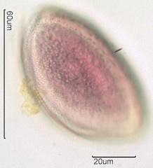Snow Lily Pollen under the Microscope