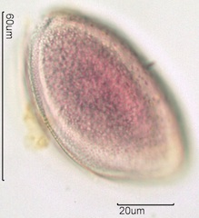 Snow Lily Pollen under the Microscope