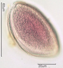 Snow Lily Pollen under the Microscope