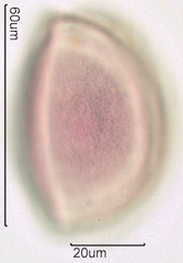 Snow Lily Pollen under the Microscope