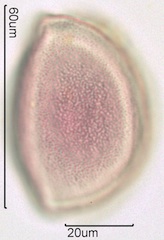 Snow Lily Pollen under the Microscope