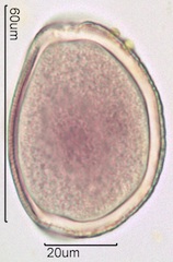 Snow Lily Pollen under the Microscope