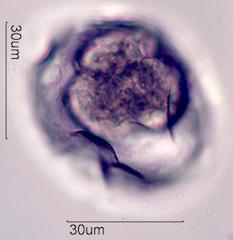 Trumpetbush (Tecoma stans) Pollen under the Microscope