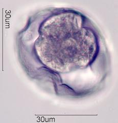 Trumpetbush (Tecoma stans) Pollen under the Microscope