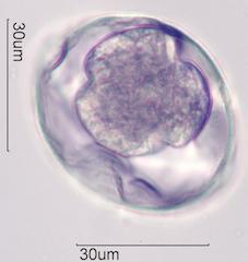 Trumpetbush (Tecoma stans) Pollen under the Microscope