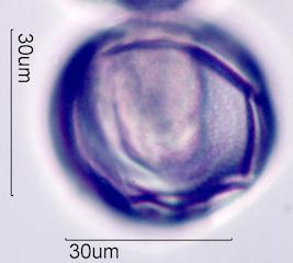 Trumpetbush (Tecoma stans) Pollen under the Microscope