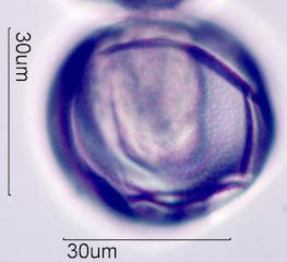 Trumpetbush (Tecoma stans) Pollen under the Microscope