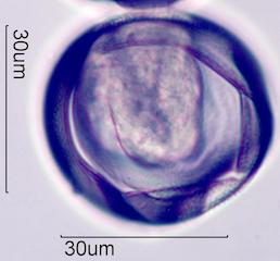 Trumpetbush (Tecoma stans) Pollen under the Microscope