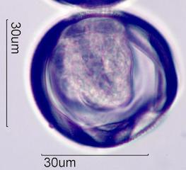 Trumpetbush (Tecoma stans) Pollen under the Microscope