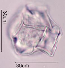 Trumpetbush (Tecoma stans) Pollen under the Microscope