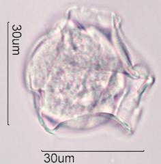 Trumpetbush (Tecoma stans) Pollen under the Microscope