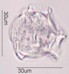 Trumpetbush (Tecoma stans) Pollen under the Microscope