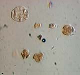 Pollen
