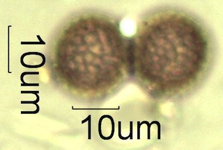 Reticulate Pollen