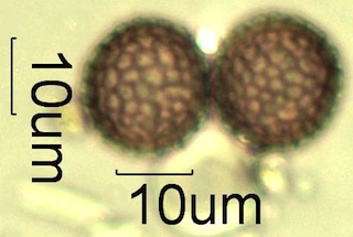 Reticulate Pollen