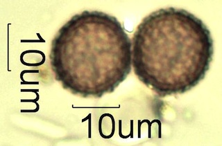 Reticulate Pollen