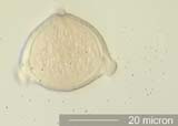 Triporate Pollen