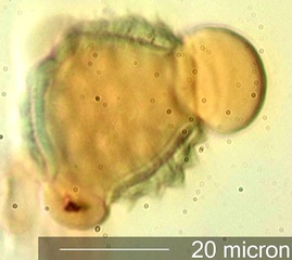 Cirsium sp. Pollen