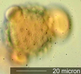 Cirsium sp. Pollen