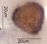 Trilete Pollen