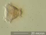 Dandelion (Taraxacum officinale) Pollen