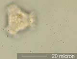 Dandelion (Taraxacum officinale) Pollen